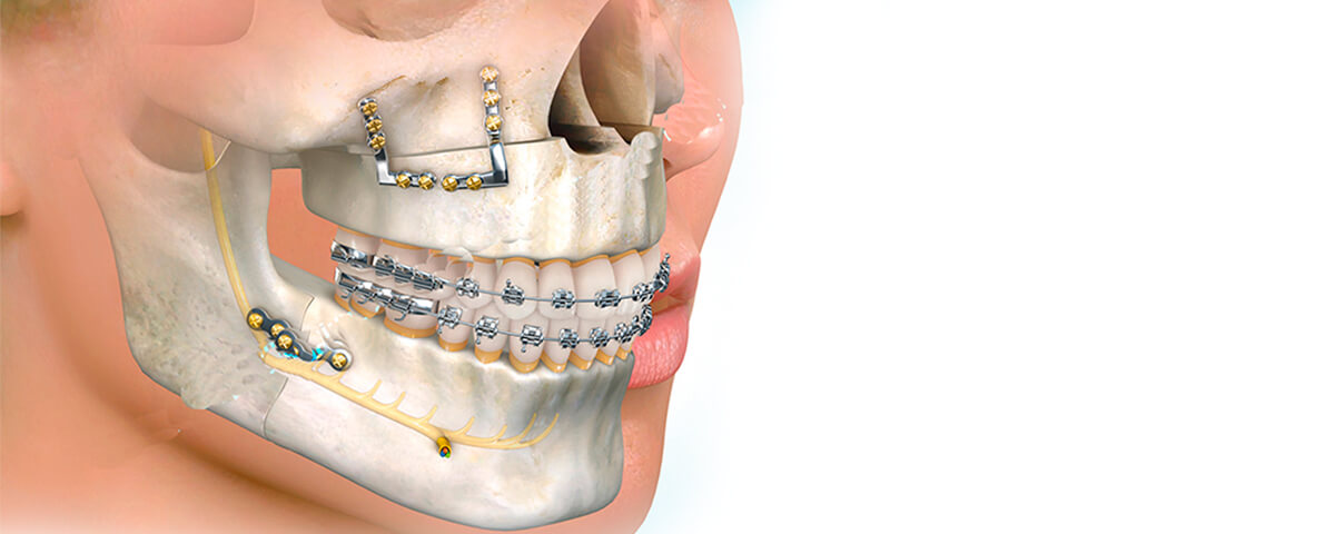 cirugia-bucal-maxilofacial-banner