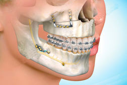 cirugia1