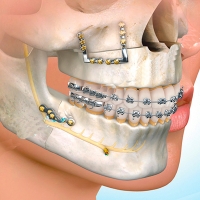 Cirugía bucal y Maxilofacial